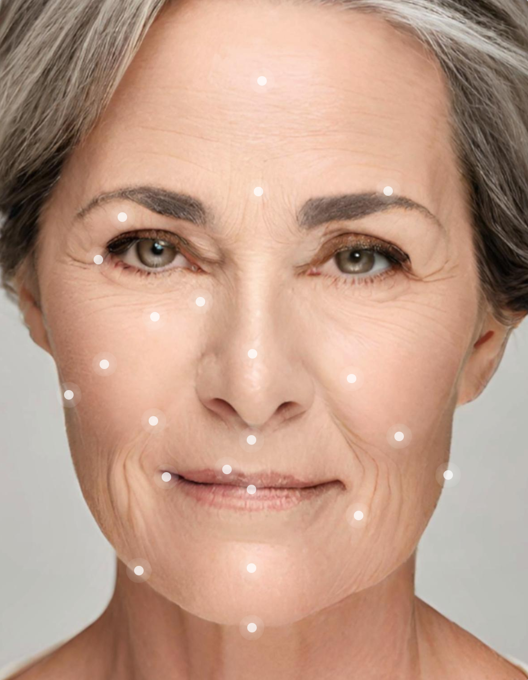 patient with Beautymapper dots on face regions